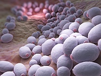 Candidiasis recurrente: más allá de la infección